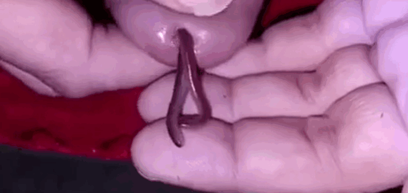 兴奋的男人想把这条虫子放进他的阴茎里 海报